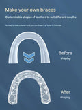 100pcs Night Grinding Braces Assisted Mouth Guard Food Grade EVA Anti-grinding Teeth Protectors